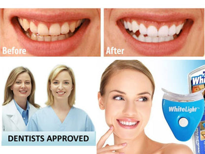 Best Teeth Whitening Kit for a Brighter Smile